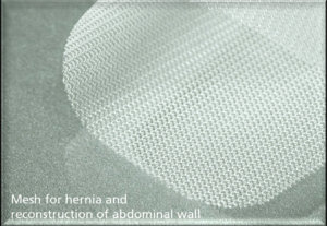 Plasa (mesa) pentru hernie